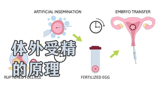 体外受精：辅助生殖中最早期的一种试管婴儿技术